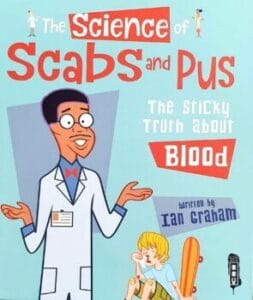 The Science of Scab and Puss: The Sticky Truth about Blood (Hardcover)